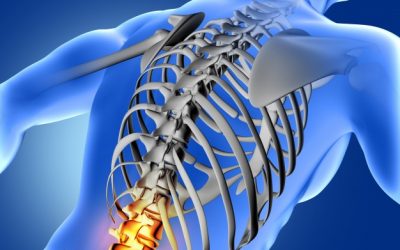 6 consejos para prevenir y mejorar los dolores de espalda